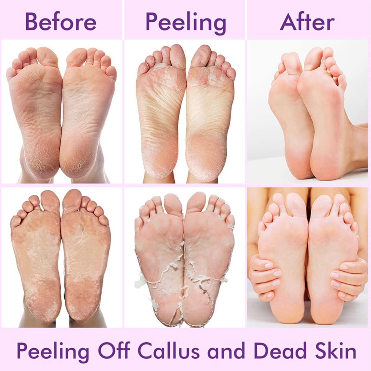 HANNEA Foot Peel Mask for Dead Skin Removal for Women, Lavender Essence Foot Mask, Soften Rough Skin Calluses Dead Skin Callus Remover (2 Pairs) HANNEA Foot Peel Mask for Dead Skin Removal for Women, Lavender Essence Foot Mask, Soften Rough Skin Calluses Dead Skin Callus Remover (2 Pairs)